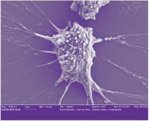 Новый источник стволовых клеток: пупочный канатик